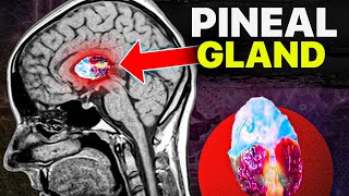 "How I Decalcified My Pineal Gland to Unlocking Higher Consciousness"