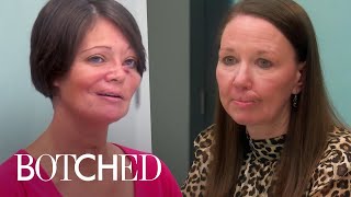 12 Minutes of UNBELIEVABLE Botched Transformations | E!