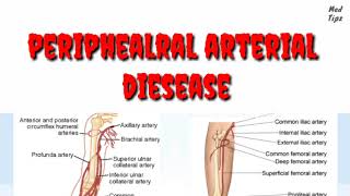 Peripheral arterial dieseas | causes,risk factors,differential daignosis,investigation,management