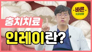 인레이는 무엇일까요? - 바른치과생활 ㅣ #인레이 #크라운 #충치치료