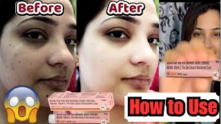 How to Use Ng Glow Cream for Best Results | Ng glow cream review | Ng glow cream