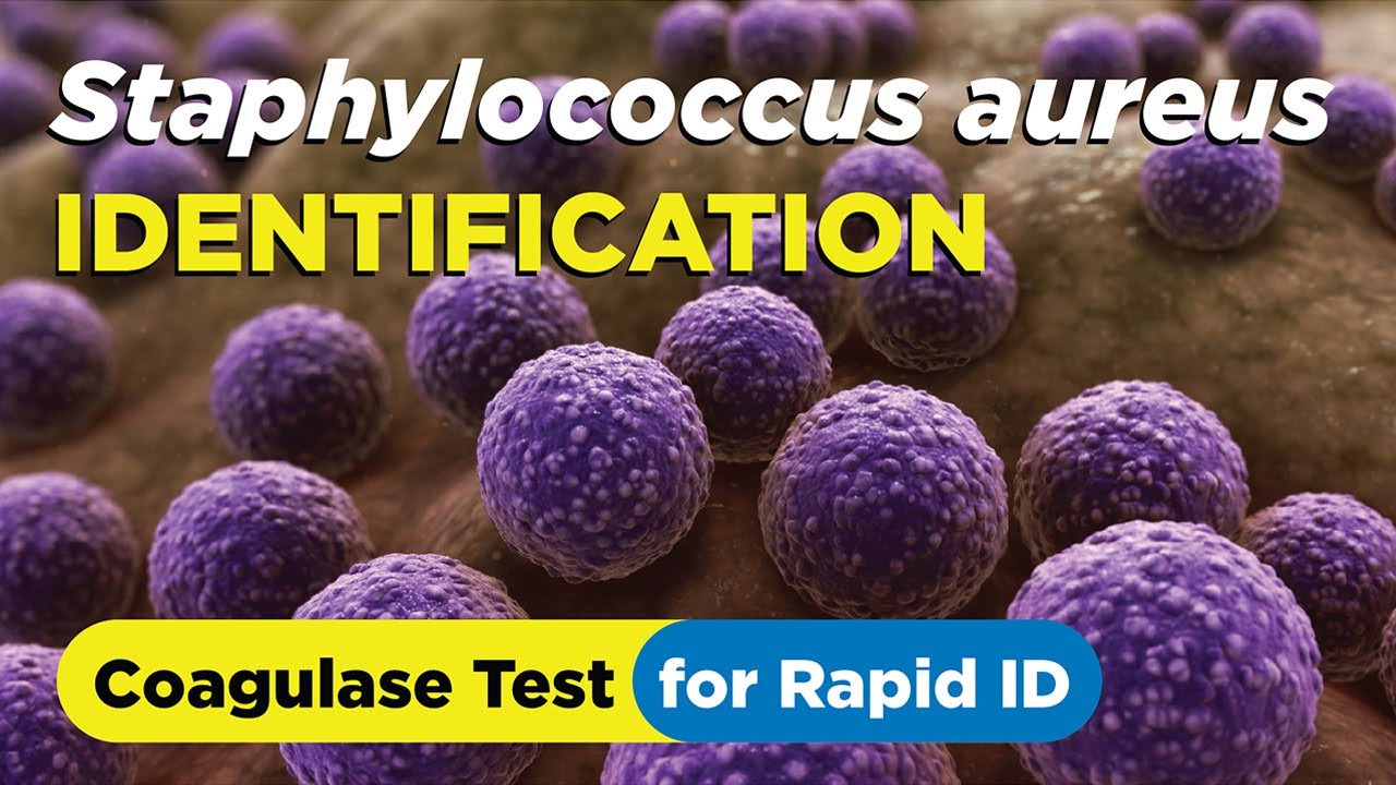 Staph Aureus Skin Infection