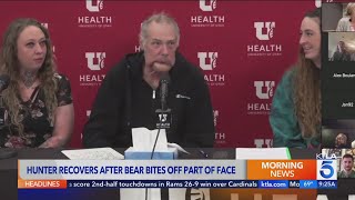 Montana man survives grizzly bear attack