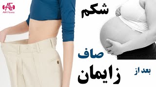 شکم تخت بعد از زایمان! با شکم بند زایمان؟!