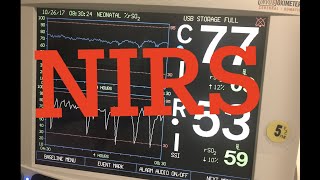 NIRS: Near infrared spectroscopy in the ICU