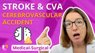 Stroke & Cerebrovascular Accident (CVA) - Medical-Surgical - Nervous System | @LevelUpRN
