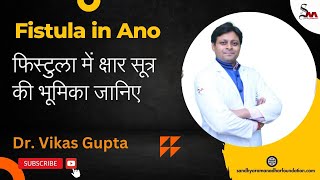 फिस्टुला में क्षार सूत्र की भूमिका | Fistula in Ano | Dr. Vikas Gupta | SRAF