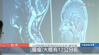 國中生不明頭頸痛 竟是少見脊髓腫瘤