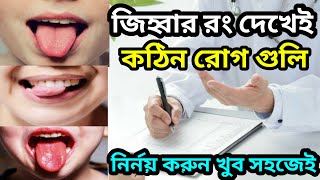 জিহ্বার রং বলে দিবে আপনি কোন রোগে আক্রান্ত | What is the color of the tongue?|