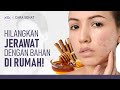 Hanya 2 Bahan! Masker Alami untuk Atasi Jerawat | Hidup Sehat tvOne