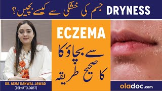 Eczema Ka Ilaj - Skin Dryness Causes - Eczema Treatment Urdu - Skin Ki Khushki Khatam Karne Ke Liye