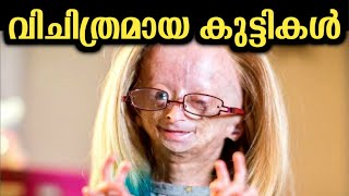 അസാധാരണമായ ചില കുട്ടികൾ | Unusual kids  Who Look Much Older Than Their Age