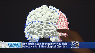 It May Be Possible To Detect Mental, Neurological Disorders With Brain Scan Technology