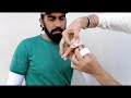 mallet splint treatment of mallet finger in urdu hindi