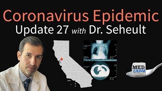 Coronavirus Epidemic Update 27: Testing accuracy for COVID-19 (CT Scan vs. RT-PCR), California Cases