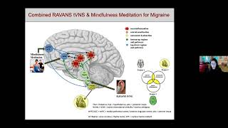 McCance Seminar Series: Randy Gollub, MD, PhD