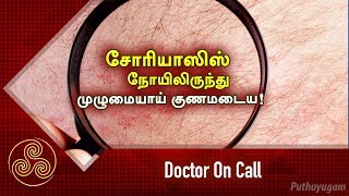 சோரியாஸிஸ் நோயிலிருந்து முழுமையாய் குணமடைய!  Doctor On Call | 14/03/2019