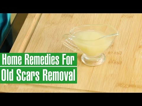 HOW TO REMOVE OLD SCARS FROM LEGS & FACE - Natural Scar Removal HOW TO REMOVE OLD SCARS FROM LEGS & FACE - Natural Scar Removal