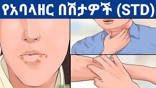 የአባላዘር በሽታዎች | STD |