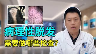 【毛发知识】病理性脱发需要做哪些检查？出现脱发问题首先要排除身体原因！雍禾植发|陶彦君医师