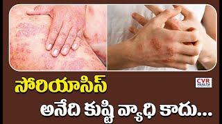 సోరియాసిస్ అనేది కుష్టి వ్యాధి కాదు | Psoriasis is Not a Disease Leprosy | CVR Health