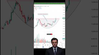 Rounding bottom pattern setup #trading #chartpatterns #trending