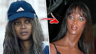 Top 10 Celebrity Surgeries That Turned Out Horribly