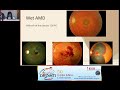 ksos 2023 ic9 diagnostic accuracy through retinal imaging a case based discussion