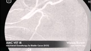 Interventional Radiology: Intra-Arterial Chemotherapy for Bladder Cancer