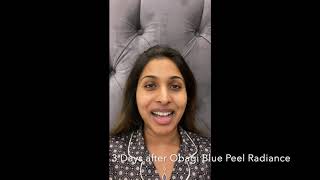 What to expect during and after Obagi Blue Peel Radiance at Skin Enhance Clinic