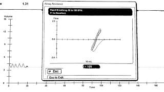 Body Plethysmography demonstration