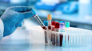 Increasing National Access to mpox Testing by Leveraging Reference Laboratory Capacity