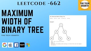 Maximum Width of Binary Tree | Leetcode 662 (Java Solution Explained)