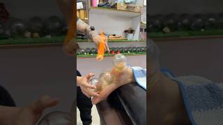 Her legs burned 😱#asmr #shorts #explore #massage #viral #cupping #youtubeshorts #fire