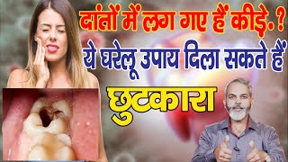 दांतों में कीड़े कैविटी का घरेलू इलाज | Home Remedies for Cavity in Teeth