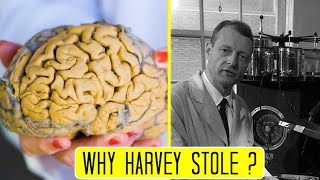 Why Harvey Stole Albert Einstein's Brain?