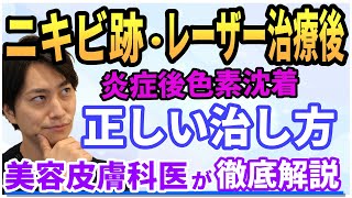 【シミ改善】炎症後色素沈着の治し方を徹底解説しました