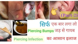 Piercing Bumps, Yellow, White pus गायब करने का आसान व घरेलू उपाय ll Home Remedies ll Part-2 ll