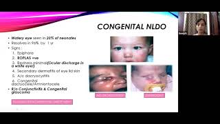 Common Pediatric Eye Disorders  | Pediatric Ophthalmology Webinar