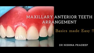 Maxillary anterior teeth arrangement 👍 Stepwise demo of the guidelines .