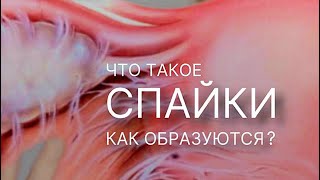 Слово «спайки» знают все, но все-же что это такое ?