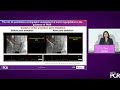 Cutting-edge technologies: clinical updates on TES, BRS, TAVR and LAA closure - EuroPCR 2023