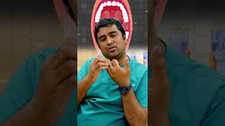 டான்சில் சதை - உன்மையில் பிரச்சனையா ? Dealing with Tonsil Troubles: Causes and Solutions Short 2