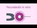 Fecundación in vitro (FIV) - Proceso paso a paso