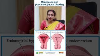 Menopouse and Post Menopausal Bleeding