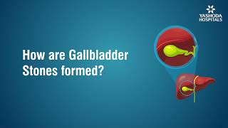 How are Gallbladder Stones formed?