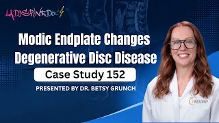 Case study 152 | Modic Endplate Changes | Degenerative Disc Disease | Explained by Dr. Betsy Grunch