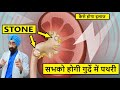 गुर्दे में पथरी | Kidney Stones - Best Explanation | Cause to Cure | Dr.Education Hindi Eng