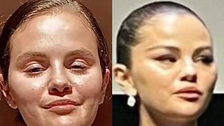 Celebs Who Are UNRECOGNIZABLE After Ruining Their Face In New Photos