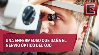 El Opinador: Glaucoma, la enfermedad que te deja ciego